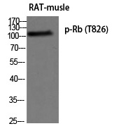 Rb (Phospho-Thr826)