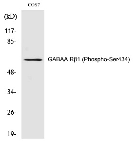 GABAA Rβ1 (Phospho-Ser434)