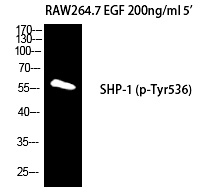 SH-PTP1 (Phospho-Tyr536)