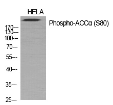 ACCα (Phospho-Ser80)