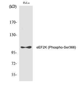 eEF2K (Phospho-Ser366)