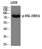 HSL (Phospho-Ser855)