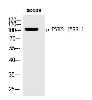 PYK2 (Phospho-Tyr881)