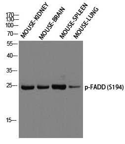 FADD (Phospho-Ser194)