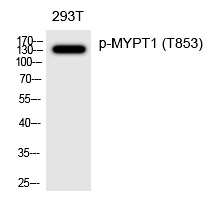 MYPT1 (Phospho-Thr853)