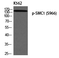 SMC1 (Phospho-Ser966)