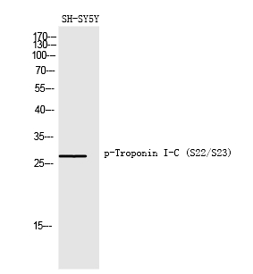 Troponin I-C (Phospho-Ser22/Ser23)