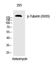 Tuberin (Phospho-Ser939)