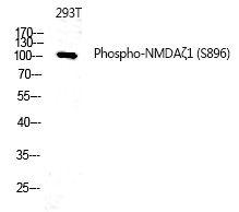 NMDAζ1 (Phospho-Ser896)