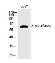 p63 (Phospho-Ser455)