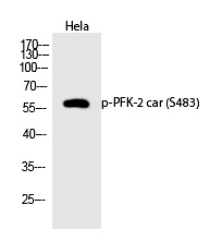 PFK-2 car (Phospho-Ser483)