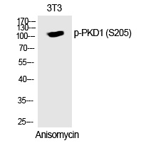 PKD1 (Phospho-Ser205)