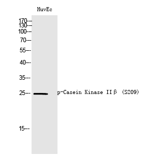 Casein Kinase IIβ (Phospho-Ser209)