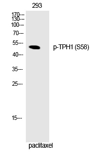 TPH1 (Phospho-Ser58)