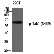 Tak1 (Phospho-Ser439)