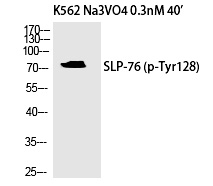 SLP-76 (Phospho-Tyr128)
