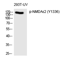 NMDAε2 (Phospho-Tyr1336)