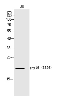 p16 (Phospho-Ser152)