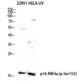 Rabbit Polyclonal Antibody to p16 (Phospho-Ser152)