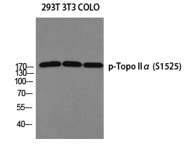 Topo IIα (Phospho-Ser1525)