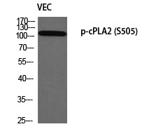 cPLA2 (Phospho-Ser505)