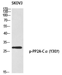 PP2A-Cα (Phospho-Tyr307)