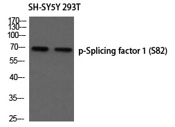 Splicing factor 1 (Phospho-Ser82)