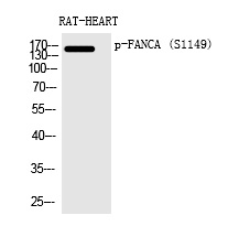 FANCA (Phospho-Ser1149)