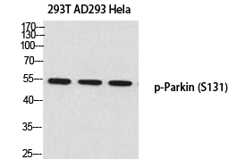 Parkin (Phospho-Ser131)
