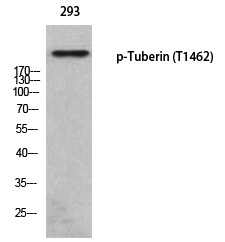 Tuberin (Phospho-Thr1462)