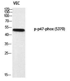 p47-phox (Phospho-Ser370)