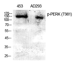 PERK (Phospho-Thr982)