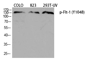 Flt-1 (Phospho-Tyr1048)