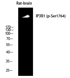 IP3R-I (Phospho-Ser1764)