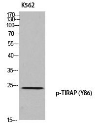 TIRAP (Phospho-Tyr86)