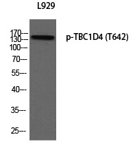 TBC1D4 (Phospho-Thr642)