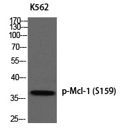 Mcl-1 (Phospho-Ser159)