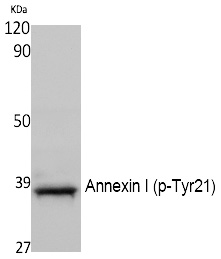 Annexin I (Phospho-Tyr21)