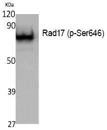Rad17 (Phospho-Ser646)