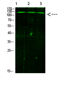 JAK2/3 (Phospho-Tyr966/939)