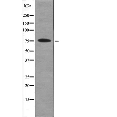 PKC β (Phospho-Ser660)