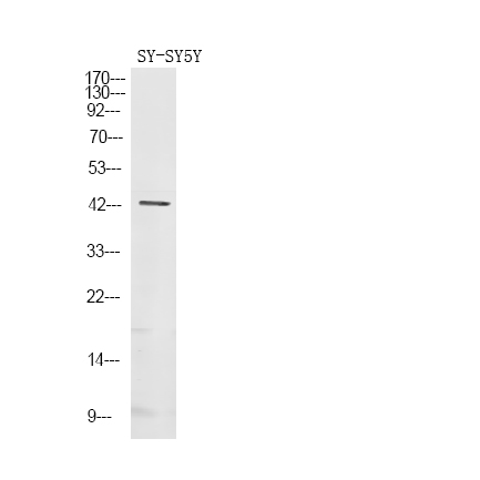 Gz-α (Phospho-Ser16)