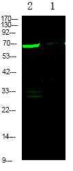 L-plastin (Phospho-Ser5)