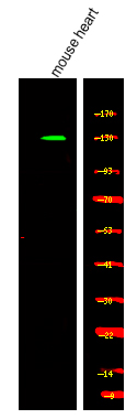 Kinesin-like Protein KIF1C (Phospho-Ser1092)