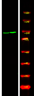 RBBP8 (Phospho-Ser664)
