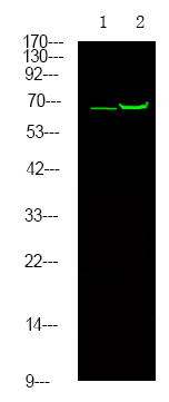 Estrogen Receptor-α (Phospho-Thr311)