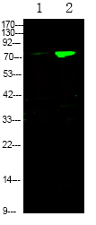 FKHRL1 (Phospho-Ser644)
