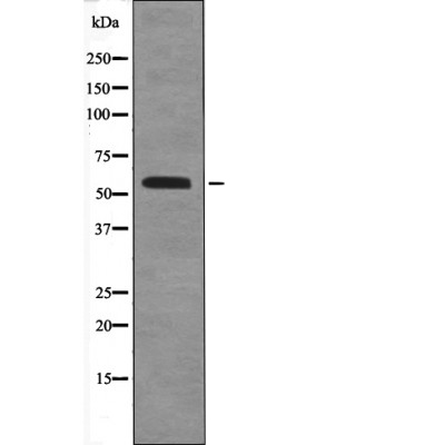 BLK (Phospho-Tyr389)