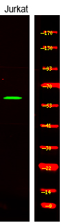CAMKK1/2 (Phospho-Ser458/495)