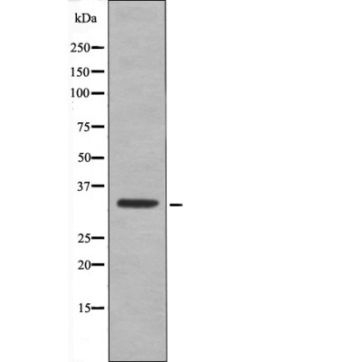 CDK1/CDC2 (Phospho-Thr161)
